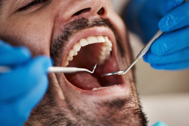 Best Emergency Treatment for Toothache in River Heights, UT