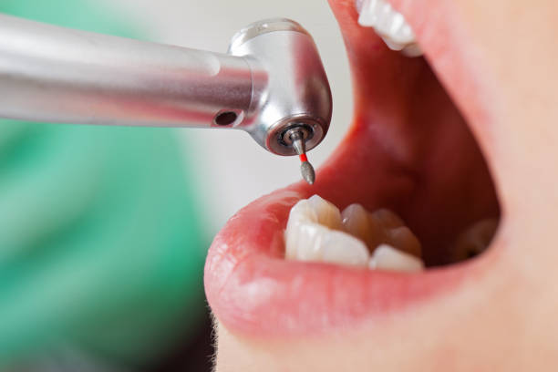 Best Emergency Dental Surgery in River Heights, UT